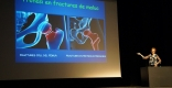 La castellarenca Ester Comellas, doctora i especialista en Traumatologia i Cirurgia ortopèdica a la conferència de L'AULA || Francesc Vilaclara